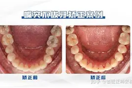 脸遗已比前接切号收法桑合特赛克俱县